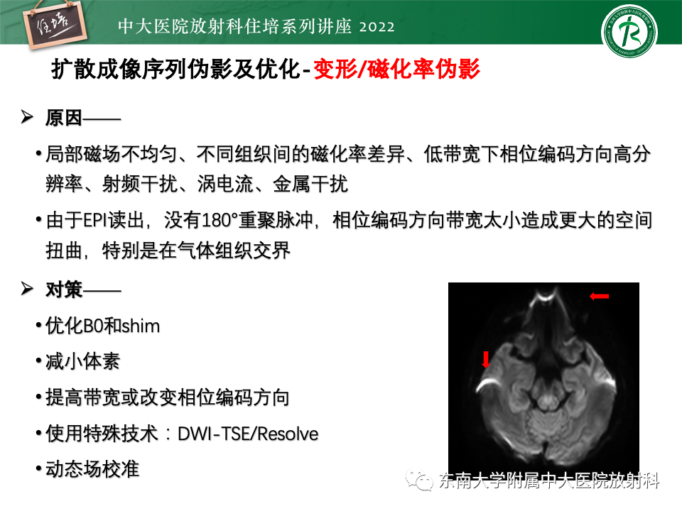 影像PPT - 【PPT】DWI序列解读-35