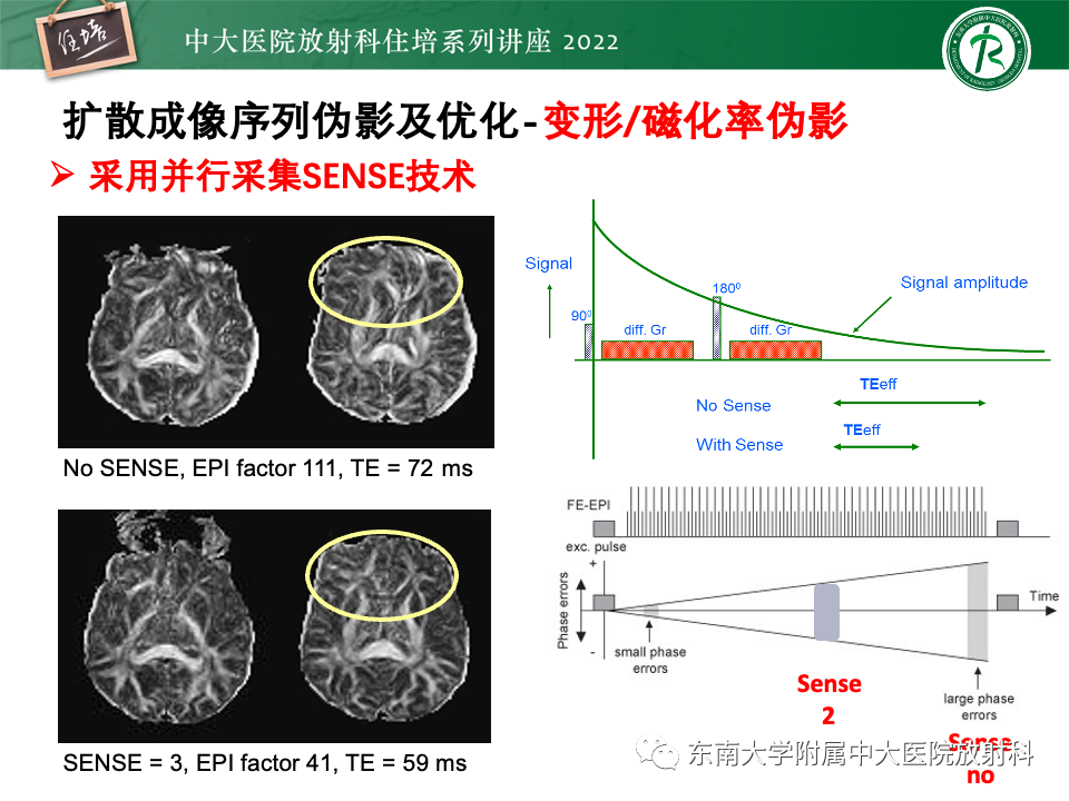 影像PPT - 【PPT】DWI序列解读-36