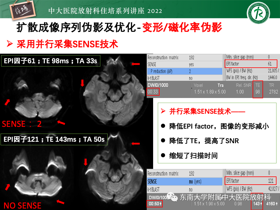 影像PPT - 【PPT】DWI序列解读-37
