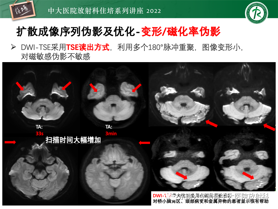 影像PPT - 【PPT】DWI序列解读-39
