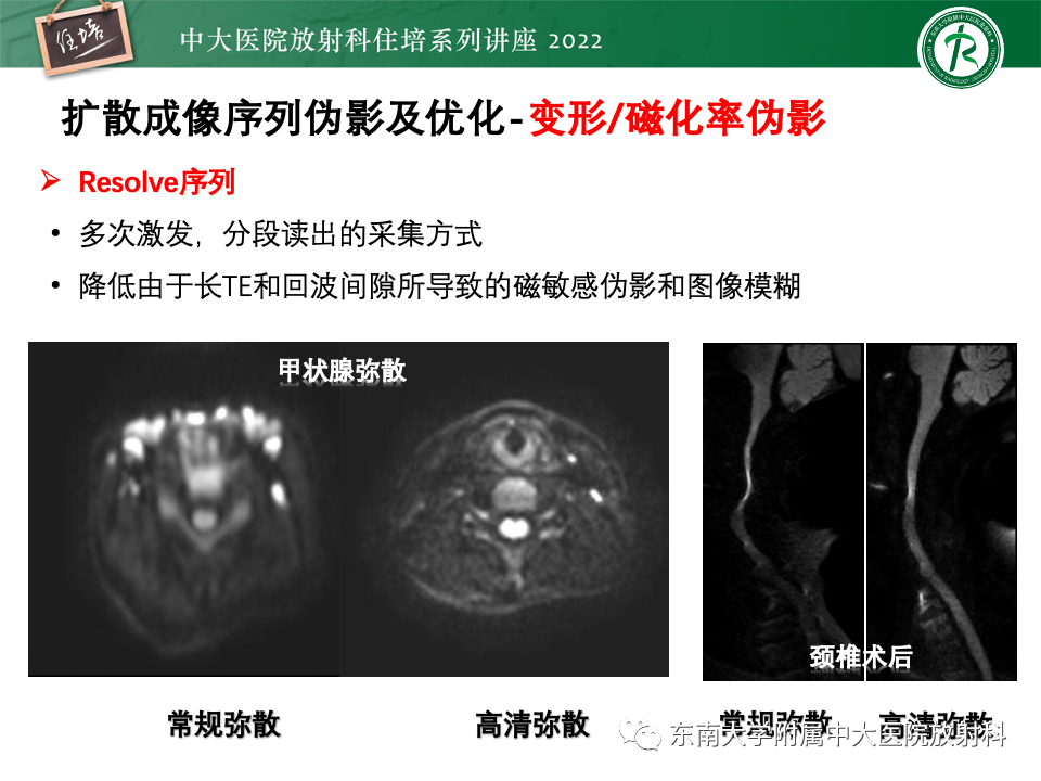 影像PPT - 【PPT】DWI序列解读-40