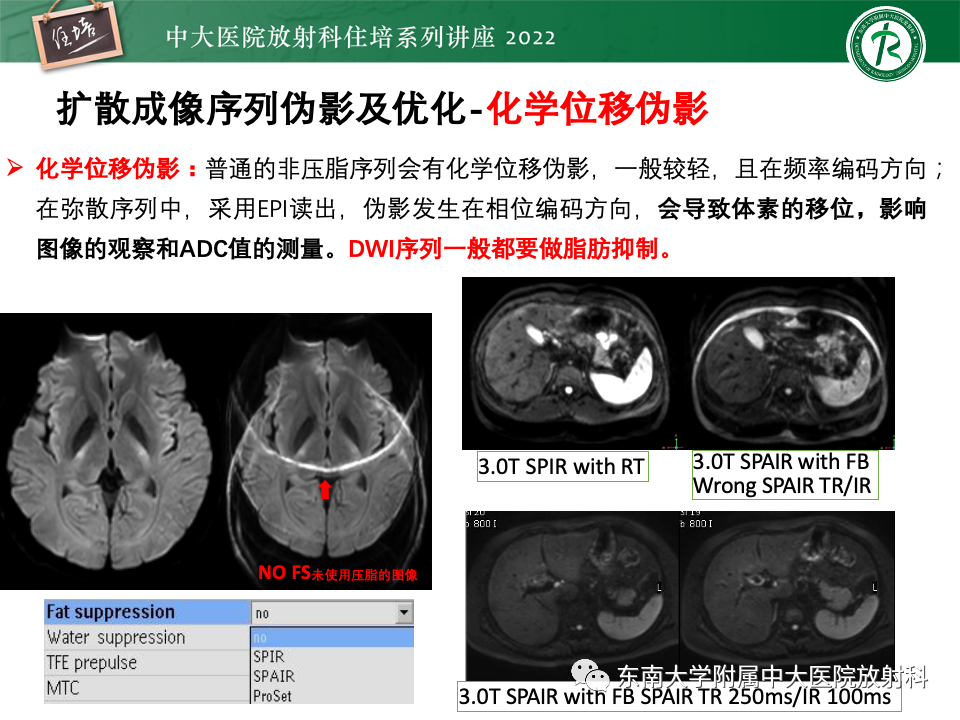 影像PPT - 【PPT】DWI序列解读-42