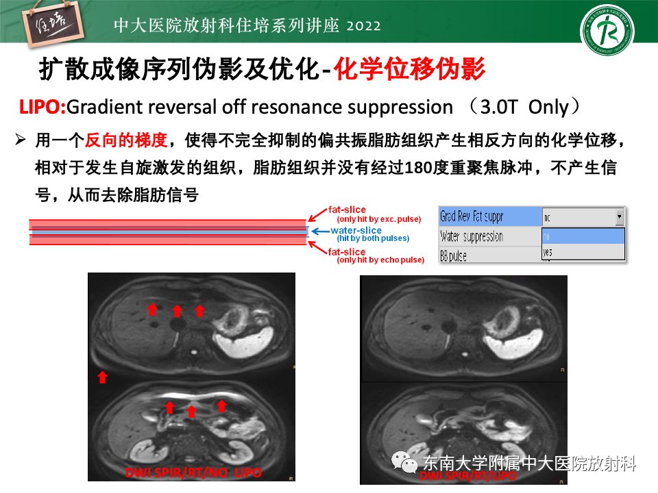 影像PPT - 【PPT】DWI序列解读-43