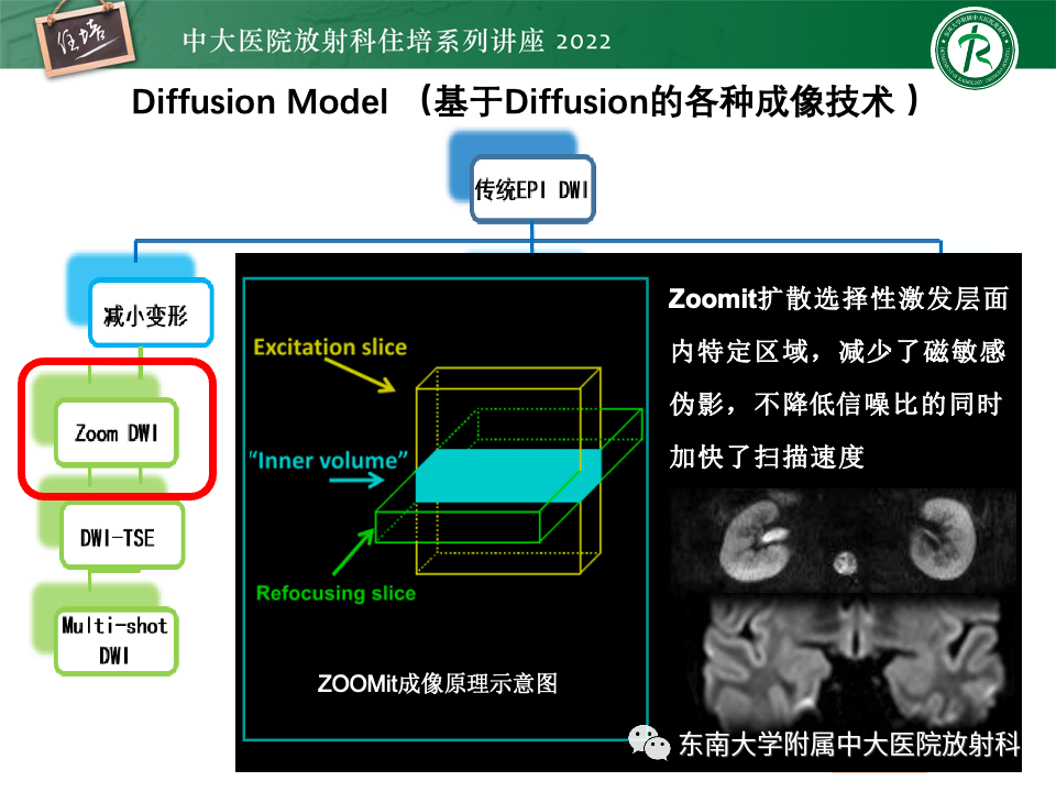 影像PPT - 【PPT】DWI序列解读-47