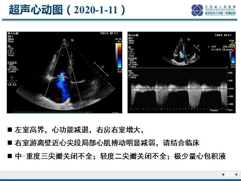 影像PPT - 【PPT】直背综合征-5