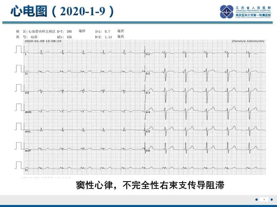影像PPT - 【PPT】直背综合征-3