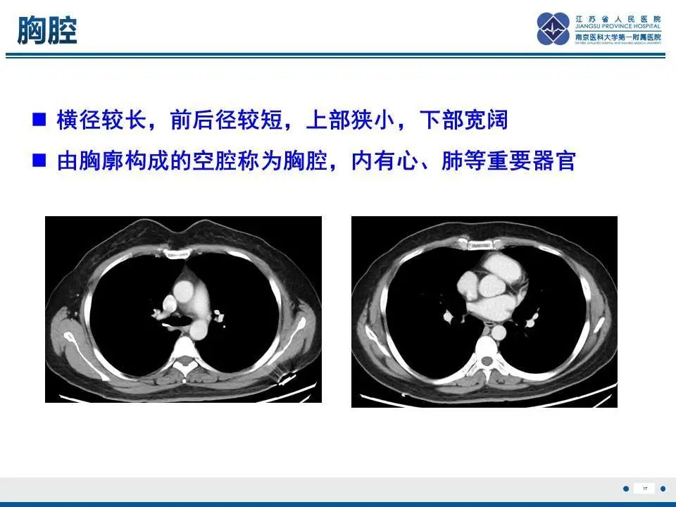 影像PPT - 【PPT】直背综合征-18