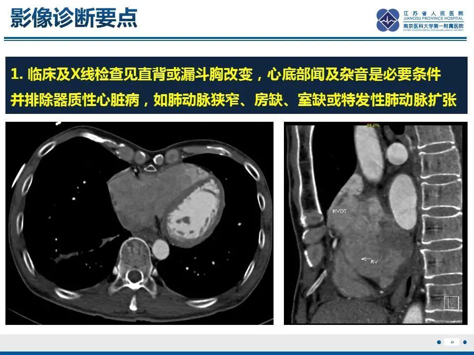 影像PPT - 【PPT】直背综合征-24
