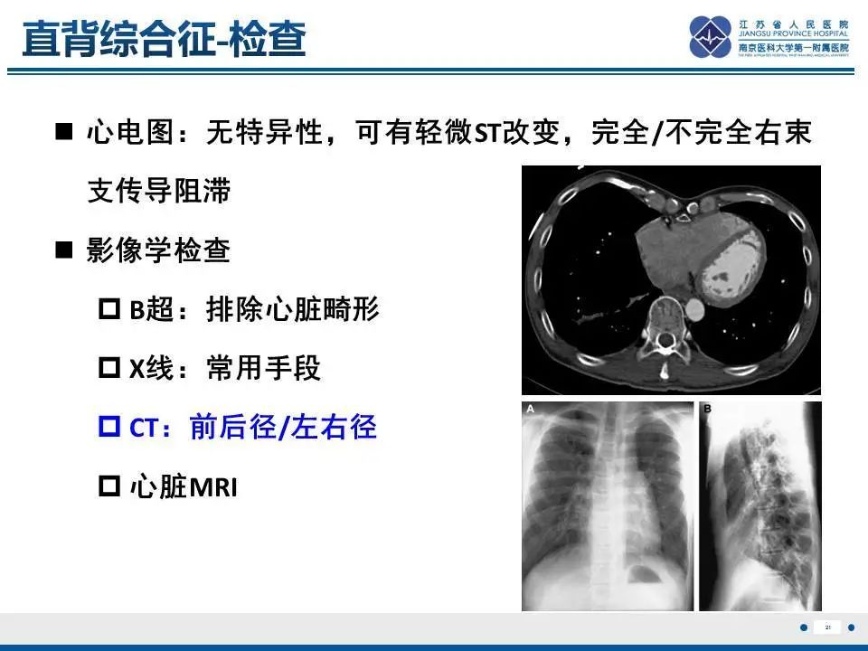 影像PPT - 【PPT】直背综合征-22