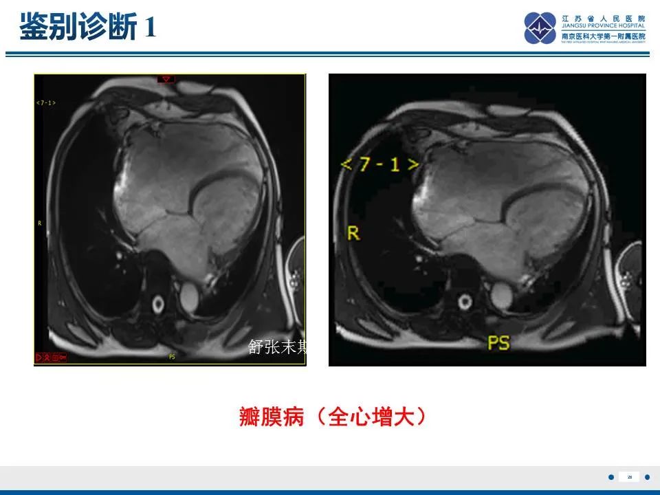 影像PPT - 【PPT】直背综合征-29