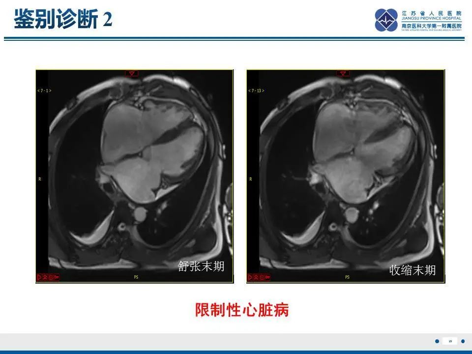 影像PPT - 【PPT】直背综合征-30