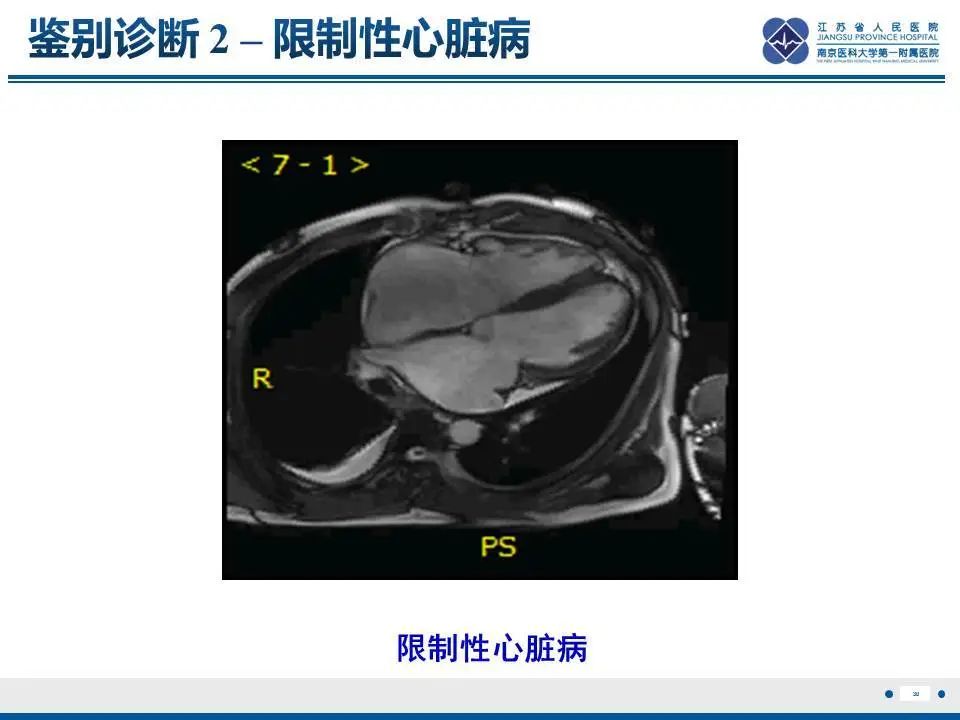 影像PPT - 【PPT】直背综合征-31