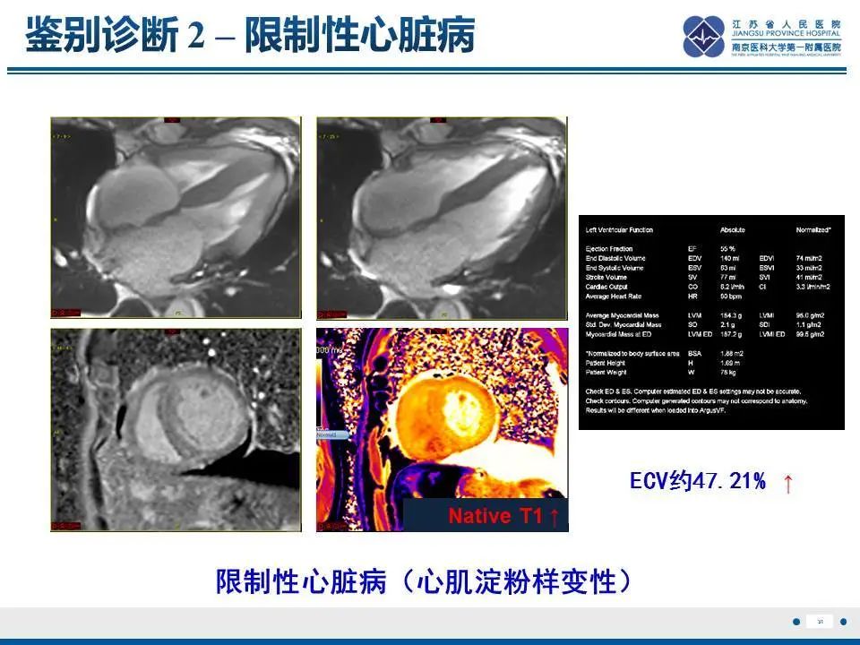 影像PPT - 【PPT】直背综合征-32