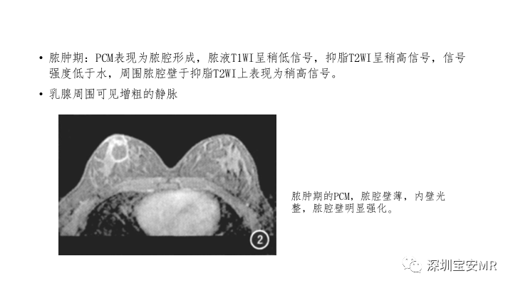 影像PPT - 【PPT】浆细胞性乳腺炎的MRI诊断-6