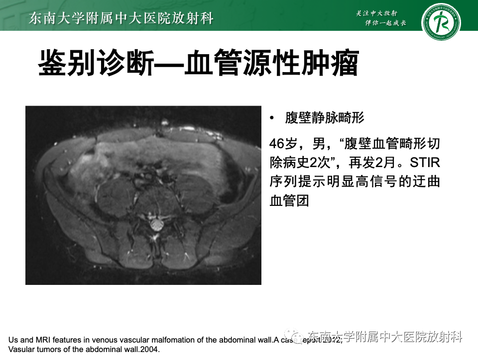 影像PPT - 【PPT】子宫内膜异位症-30
