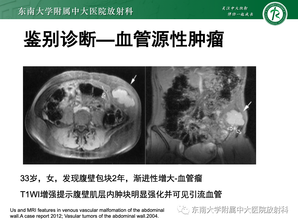影像PPT - 【PPT】子宫内膜异位症-31