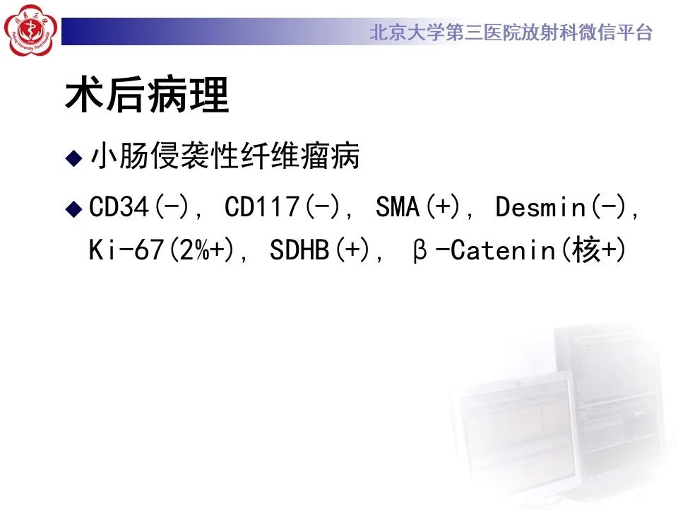 影像PPT - 【PPT】侵袭性纤维瘤病（腹内型）-10