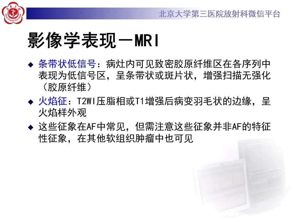 影像PPT - 【PPT】侵袭性纤维瘤病（腹内型）-19