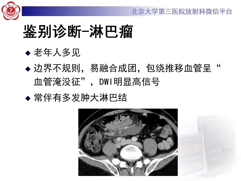 影像PPT - 【PPT】侵袭性纤维瘤病（腹内型）-24