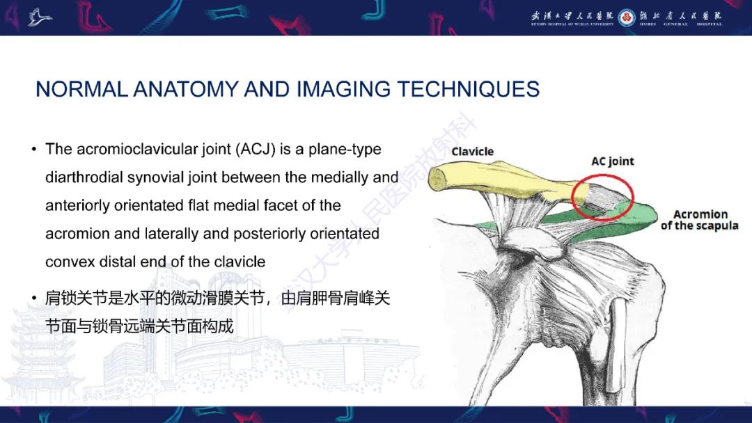 影像PPT - 【PPT】肩锁关节病变影像诊断-2