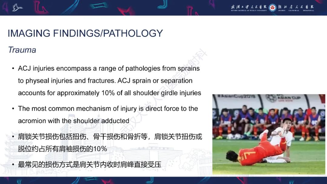 影像PPT - 【PPT】肩锁关节病变影像诊断-9