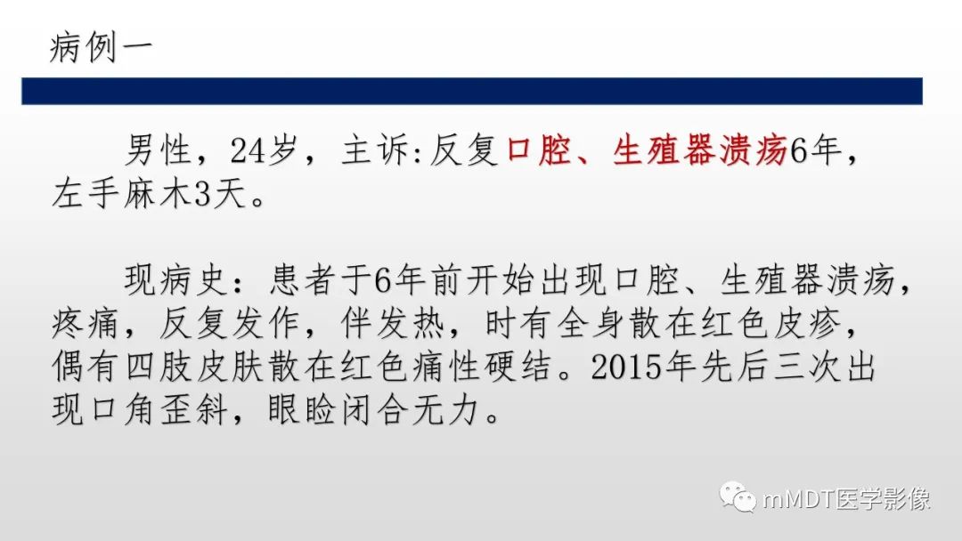 影像PPT - 【PPT】神经白塞病NBD-2