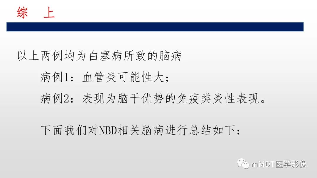 影像PPT - 【PPT】神经白塞病NBD-21