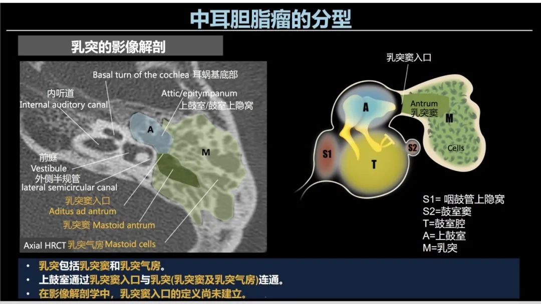 影像PPT - 【PPT】影像学方法术前预测中耳胆脂瘤的乳突侵犯-12