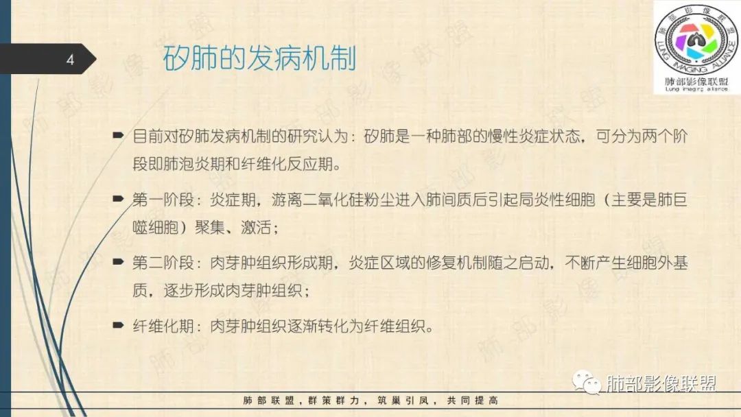 影像PPT - 【PPT】矽肺CT特点-4 影像PPT - 【PPT】矽肺CT特点-4