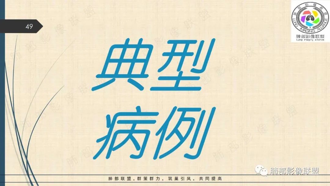 影像PPT - 【PPT】矽肺CT特点-49 影像PPT - 【PPT】矽肺CT特点-49