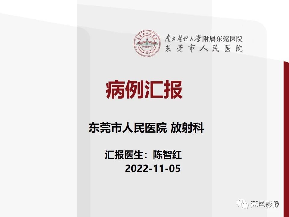 影像PPT - 【病例】室管膜下星形细胞瘤1例CT及MR-1