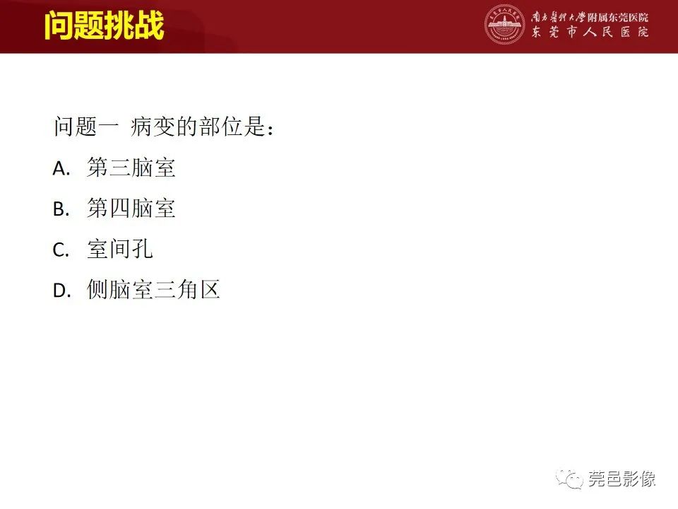 影像PPT - 【病例】室管膜下星形细胞瘤1例CT及MR-13