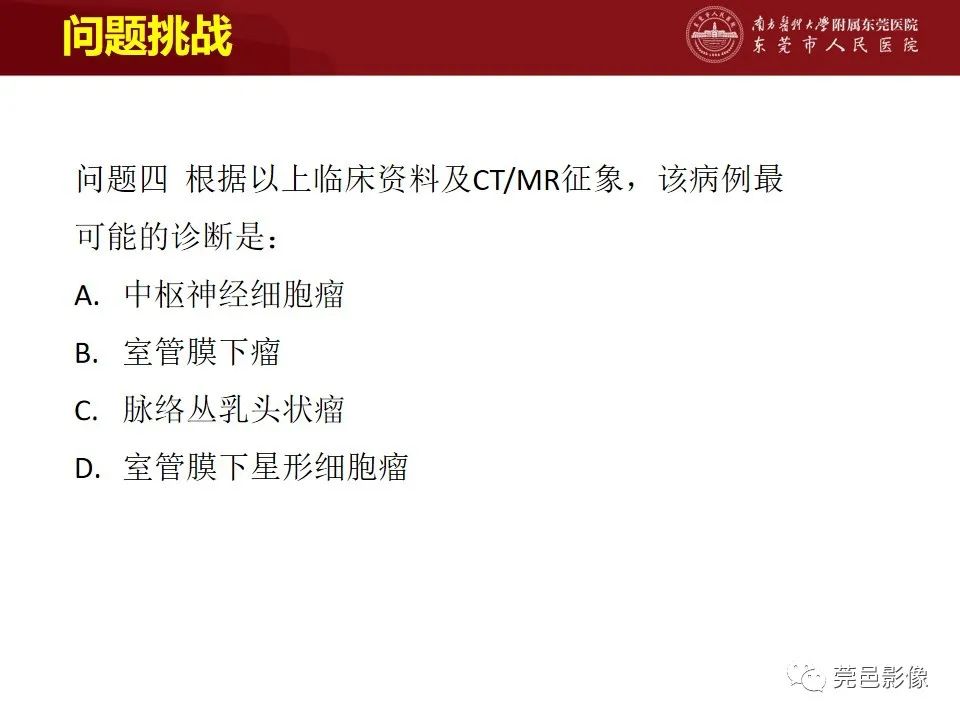 影像PPT - 【病例】室管膜下星形细胞瘤1例CT及MR-16