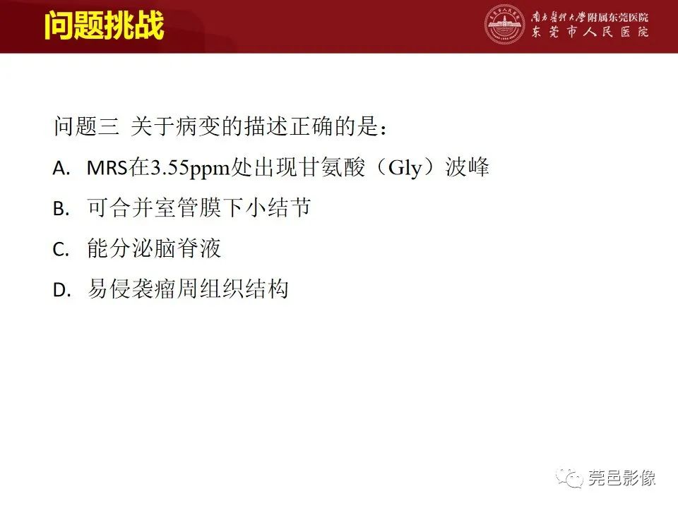 影像PPT - 【病例】室管膜下星形细胞瘤1例CT及MR-15