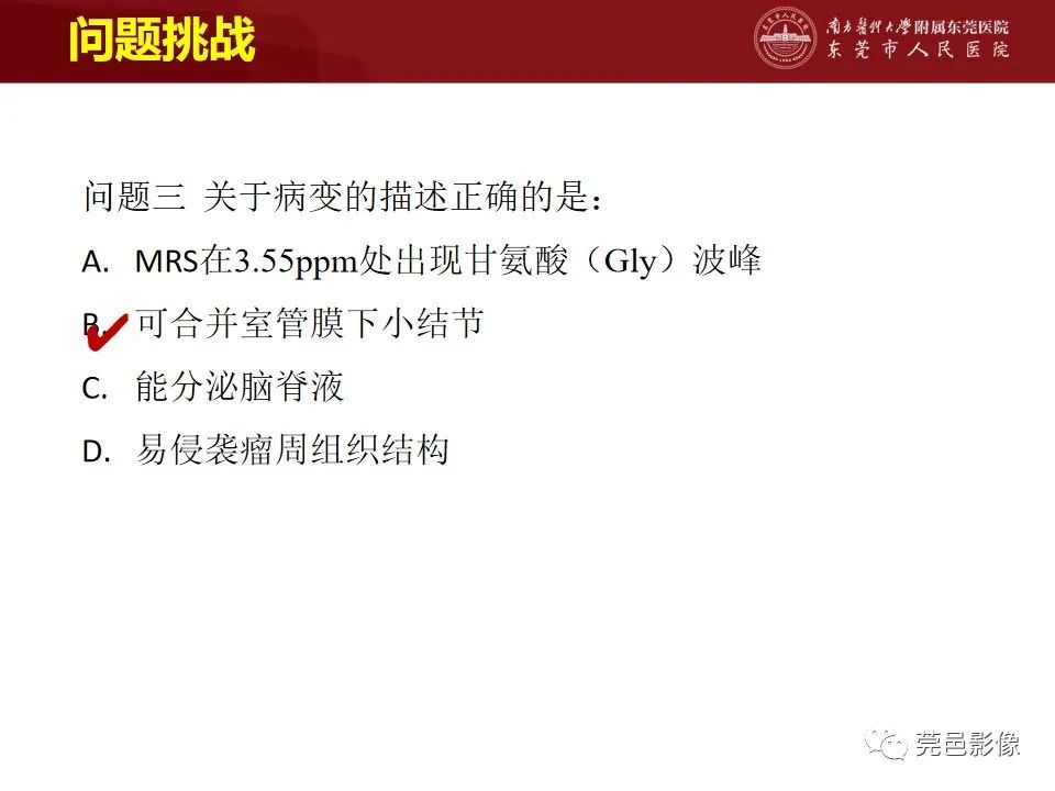 影像PPT - 【病例】室管膜下星形细胞瘤1例CT及MR-20