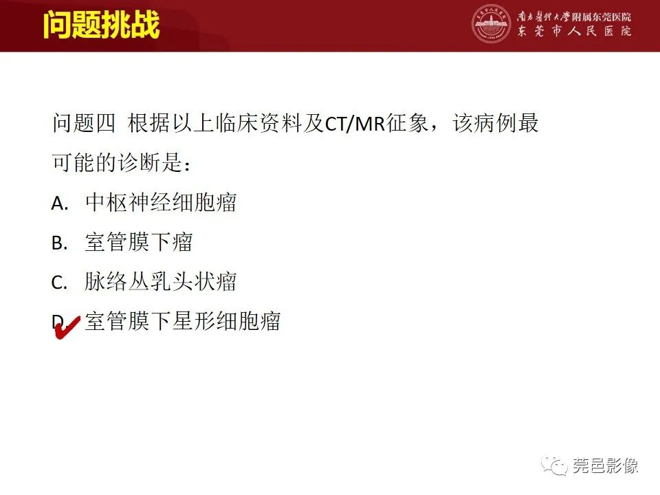 影像PPT - 【病例】室管膜下星形细胞瘤1例CT及MR-21