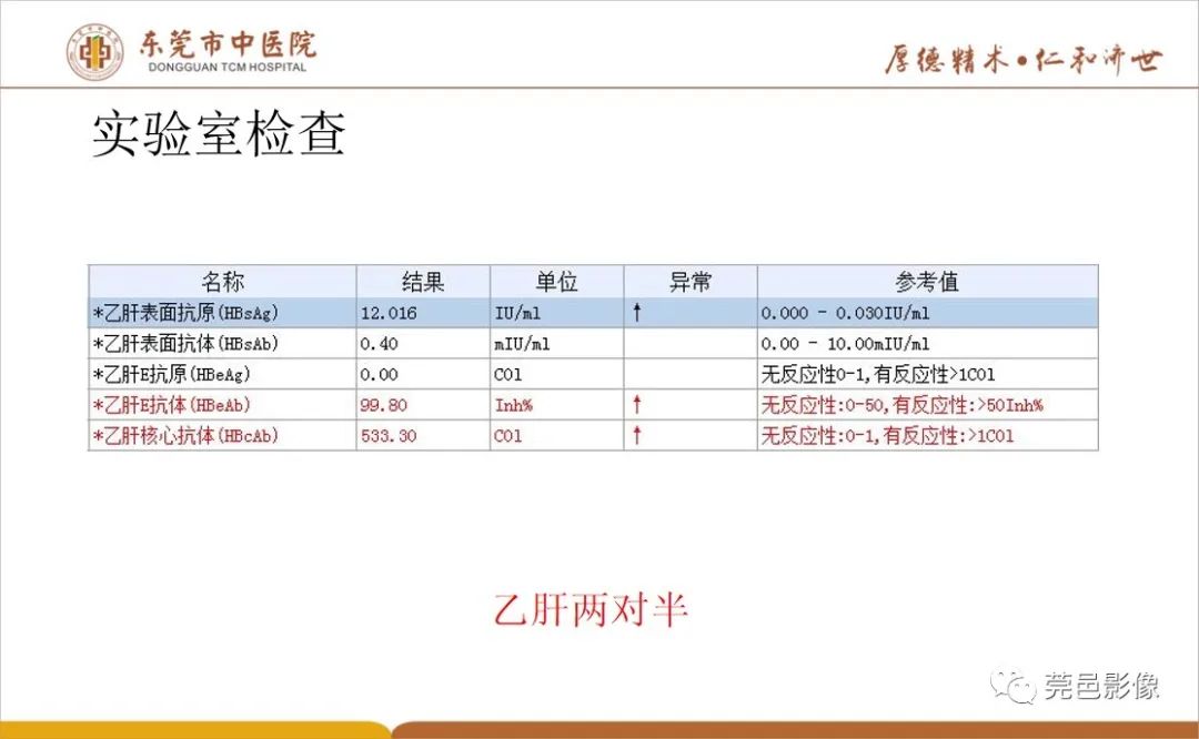 影像PPT - 【病例】肝脏非典型血管瘤1例CT及MR-5