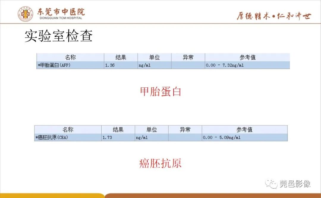 影像PPT - 【病例】肝脏非典型血管瘤1例CT及MR-6