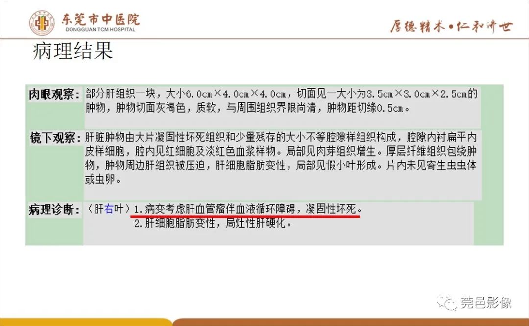 影像PPT - 【病例】肝脏非典型血管瘤1例CT及MR-33