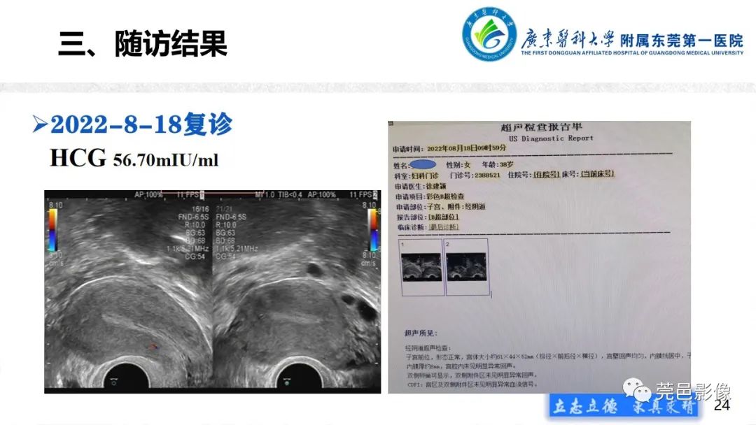 影像PPT - 【病例】不全流产1例超声及MR影像-24