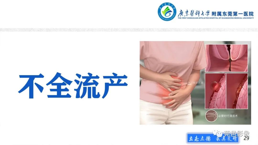 影像PPT - 【病例】不全流产1例超声及MR影像-29