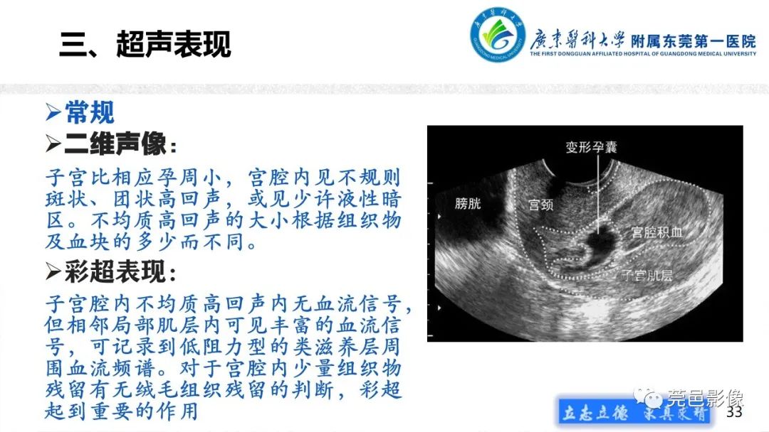 影像PPT - 【病例】不全流产1例超声及MR影像-33