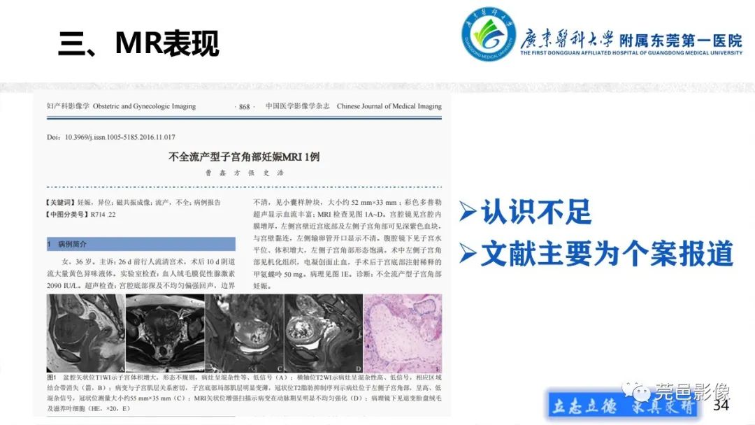 影像PPT - 【病例】不全流产1例超声及MR影像-34