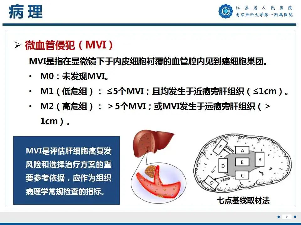 影像PPT - 【PPT】肝细胞癌—肝脏肿瘤术前MR评估-25