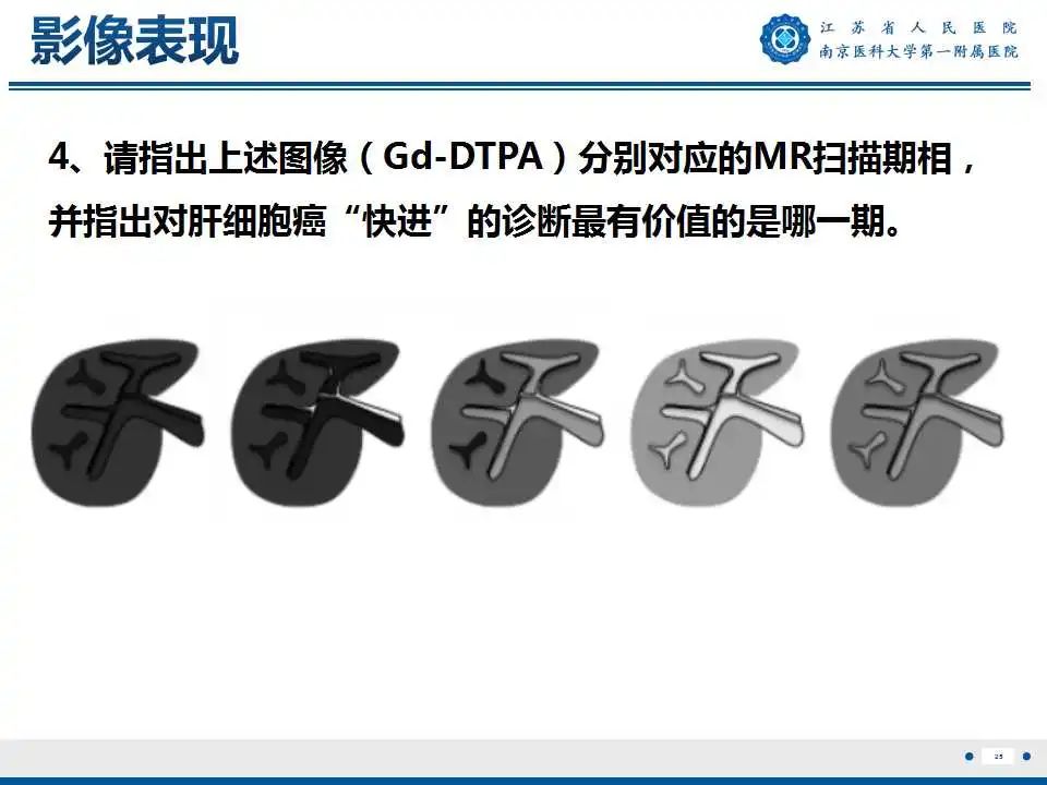 影像PPT - 【PPT】肝细胞癌—肝脏肿瘤术前MR评估-26