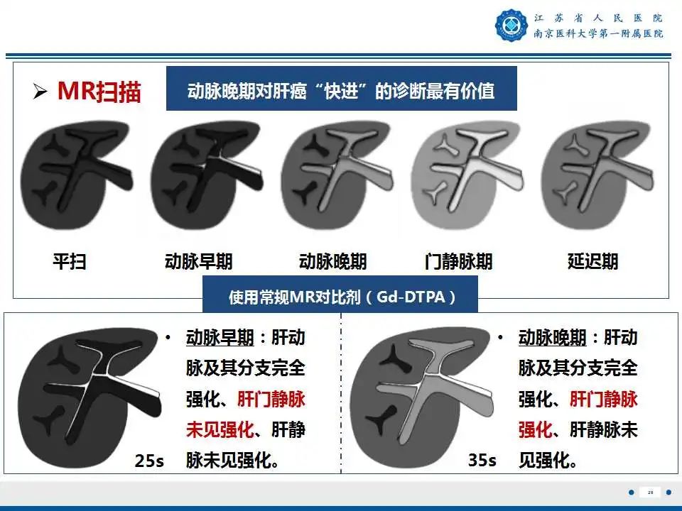 影像PPT - 【PPT】肝细胞癌—肝脏肿瘤术前MR评估-27