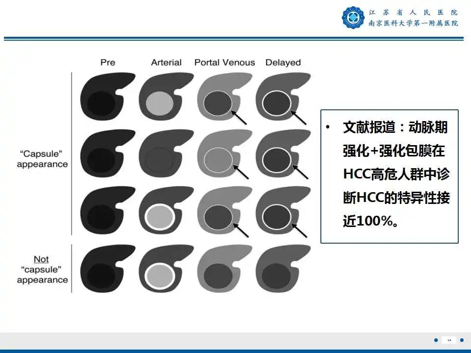 影像PPT - 【PPT】肝细胞癌—肝脏肿瘤术前MR评估-35
