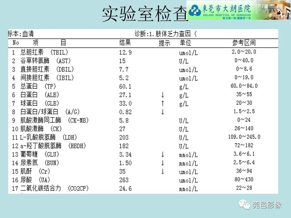 影像PPT - 【病例】线粒体脑肌病1例CT及MR-3