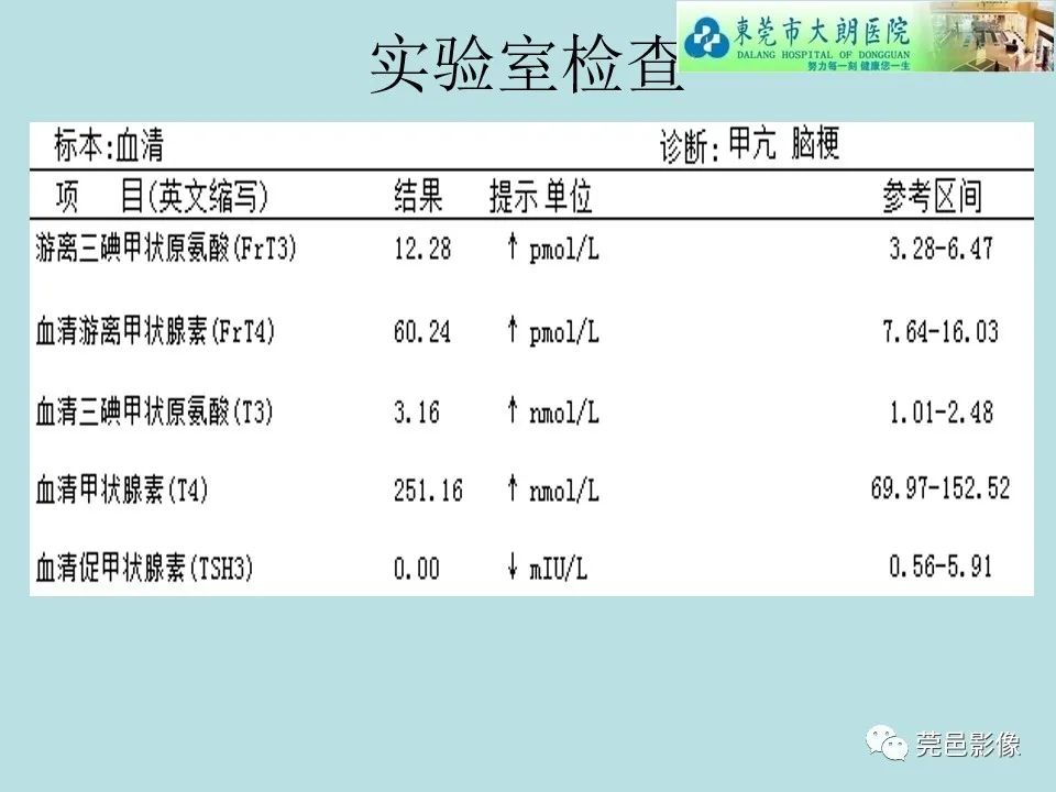 影像PPT - 【病例】线粒体脑肌病1例CT及MR-4