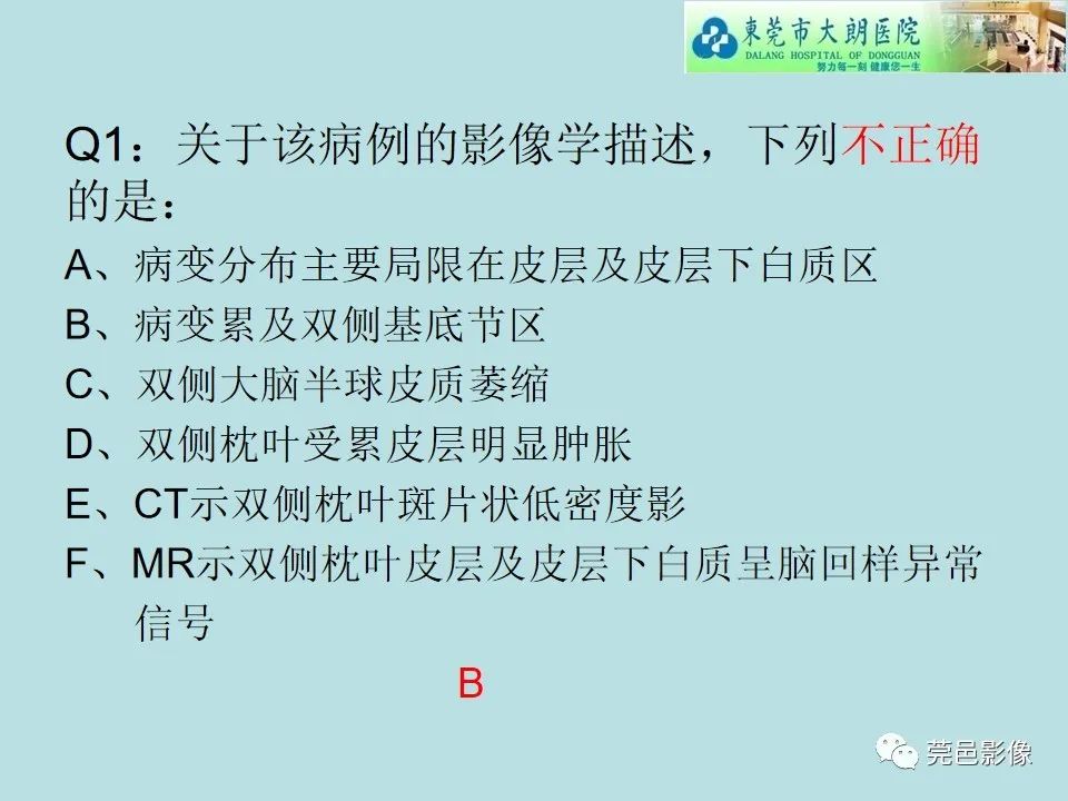 影像PPT - 【病例】线粒体脑肌病1例CT及MR-14